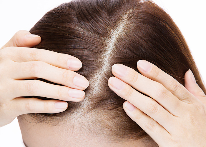 分け目が目立ち、はげているように見える