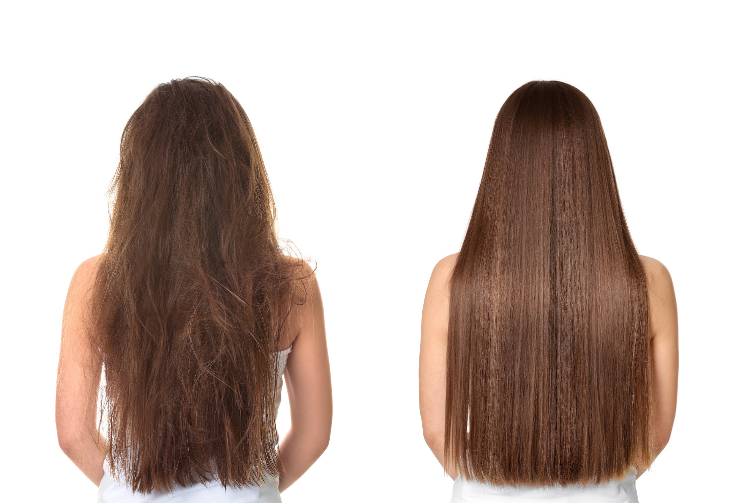 ビフォーアフター